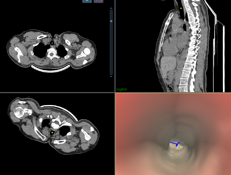 Medical Navigation Projects